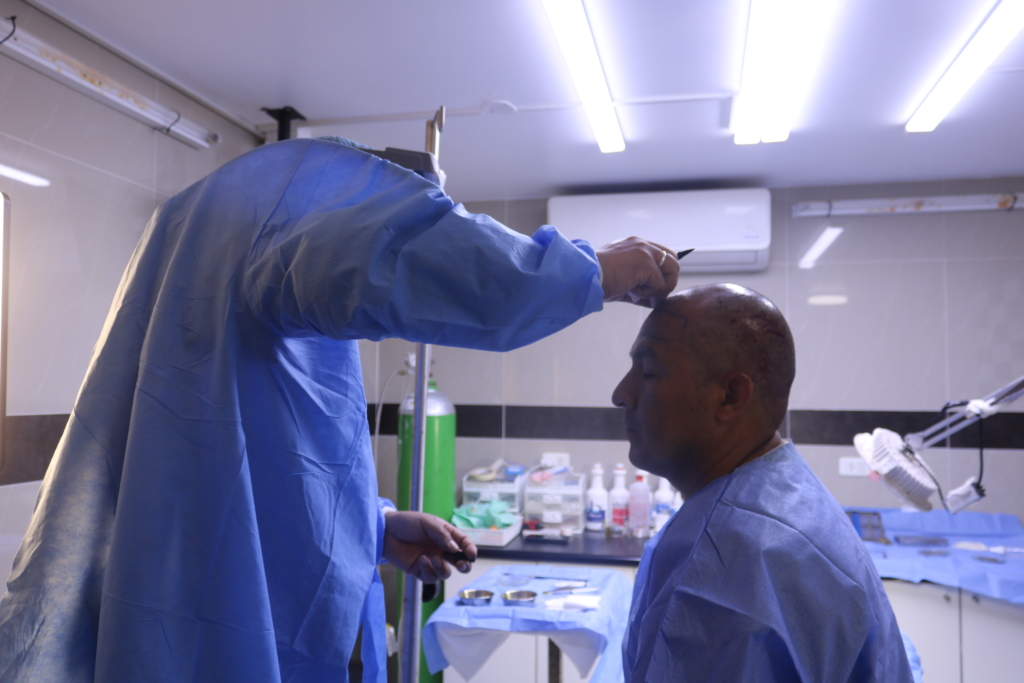 El implante capilar ha dejado de ser un procedimiento reservado para unos pocos y se ha convertido en una opción cada vez más buscada